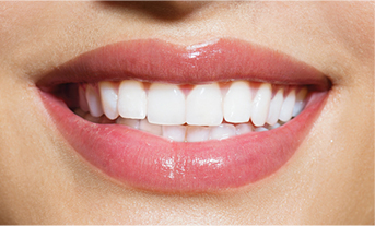 After enlighten teeth whitening - The Smile Boutique 